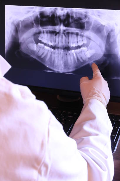Best Emergency Root Canal Treatment in Torrance, CA